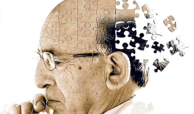 Alzheimer Nedir? Nasıl Oluşur? Tedavi Yöntemleri Alzheimer Hastalarıyla İletişim