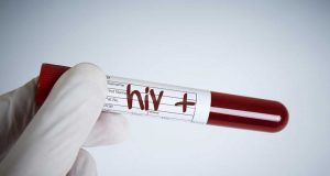 Cinsel Yolla Bulaşan Hastalıklar Cinsel Yolla Bulaşan Hastalıklar