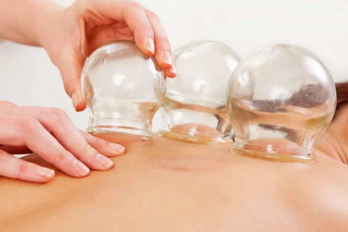 Yeni Tedavi Trendi: Hacamat (Kupa Terapisi) Hacamat (Kupa Terapisi)