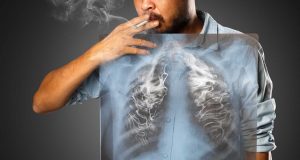 Akciğer Kanseri Nedir, Nasıl Ortaya Çıkar? Akciğer Kanseri Nedir, Nasıl Ortaya Çıkar