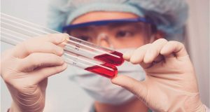 Ebola Hastalığı Ebola Hastalığı