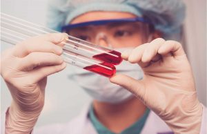 Ebola Hastalığı Ebola Hastalığı