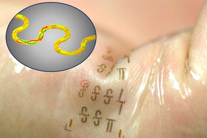 Kanseri Önceden Haber Veren Dövme Kanseri Önceden Haber Veren Dövme