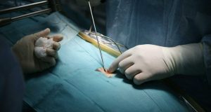 Kıl Dönmesi Nedenleri, Belirtileri ve Tedavisi Kıl Dönmesi Nedenleri, Belirtileri ve Tedavisi