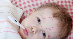 Su Çiçeği Su Çiçeği